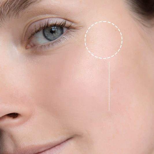 Nguy cơ da bị tăng sắc tố khi lạm dụng retinol